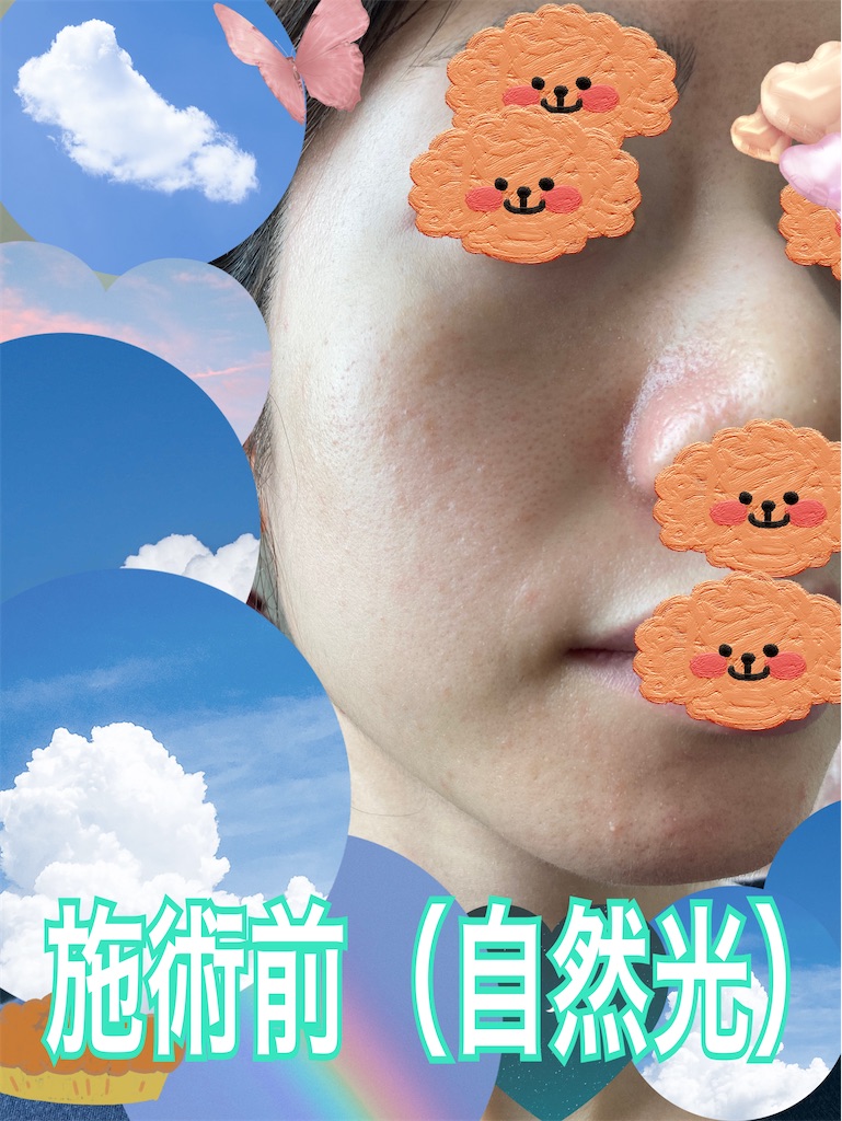 f:id:neatralll:20230531145539j:image
