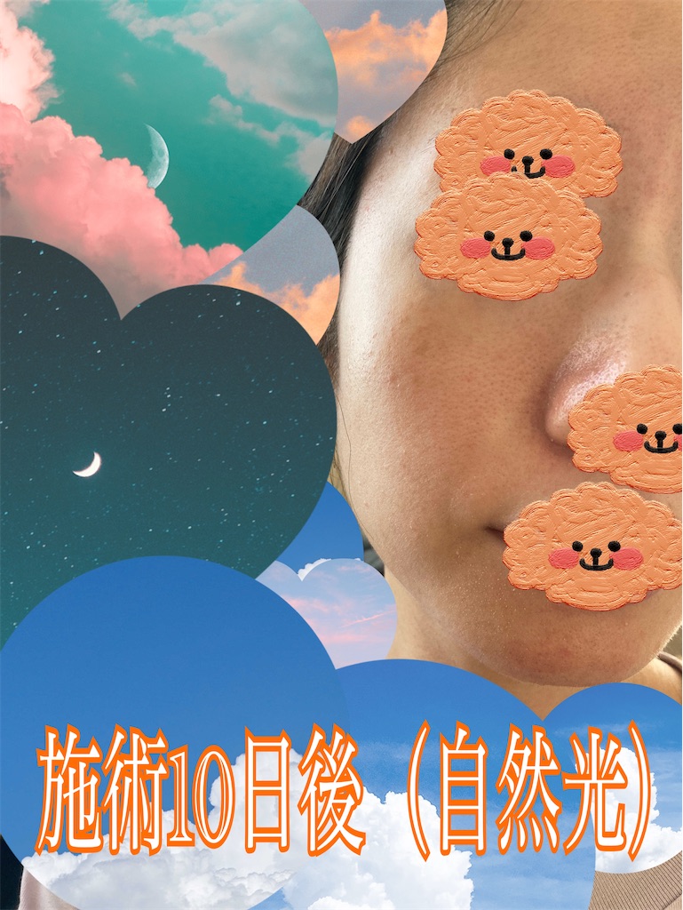 f:id:neatralll:20230531145542j:image