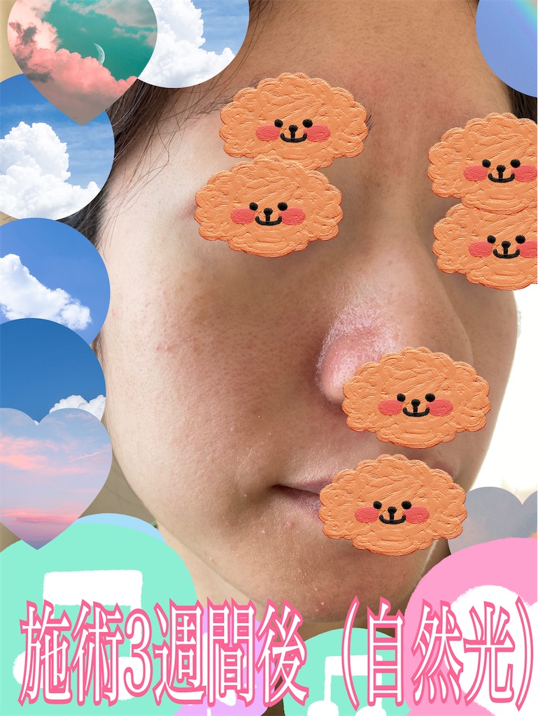 f:id:neatralll:20230531145612j:image