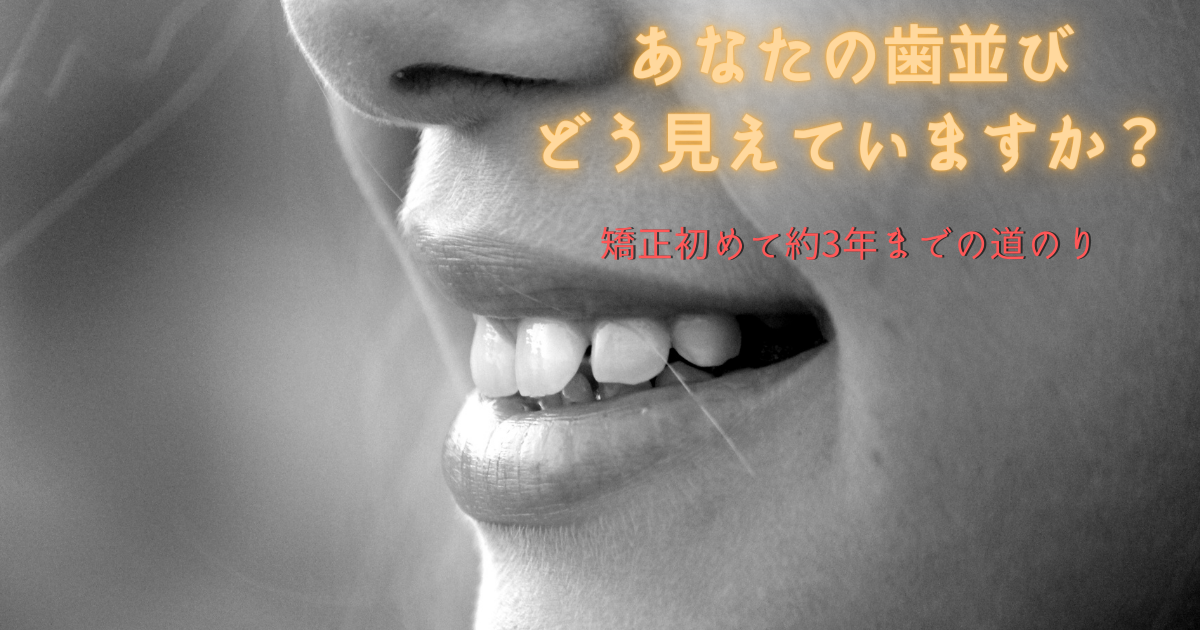f:id:neko-bloger:20211202113704p:plain