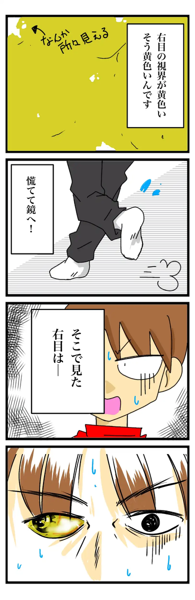 漫画:失明しかけた話3