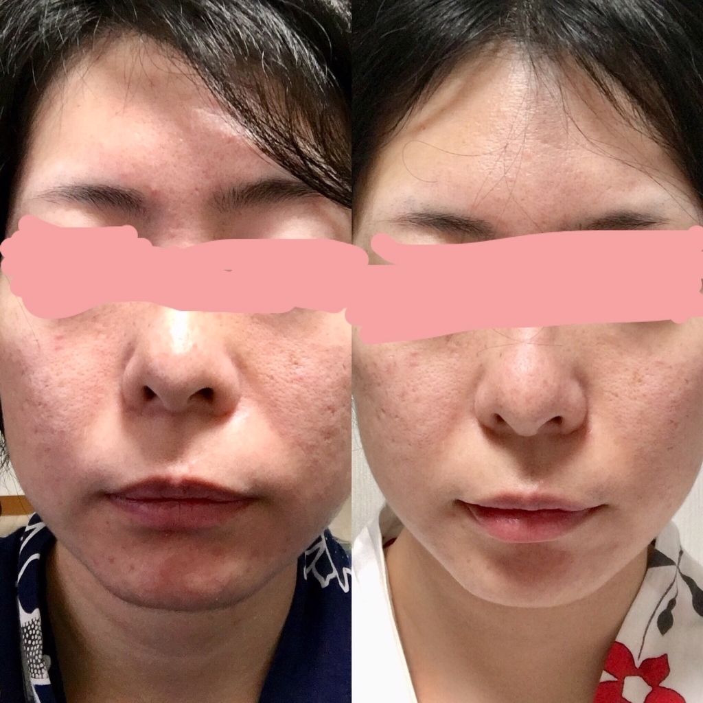 f:id:nekomaman:20190131182307j:plain