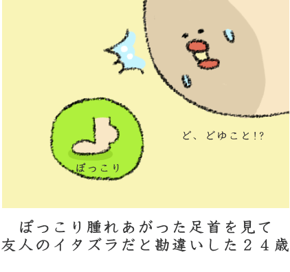 ぽっこり腫れあがった足首 ぽっこり腫れあがった足首