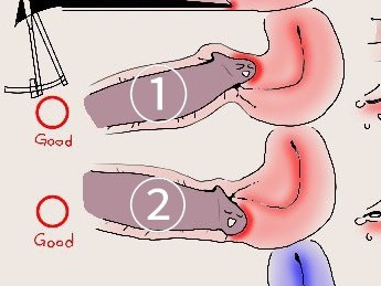 ポルチオ上側①