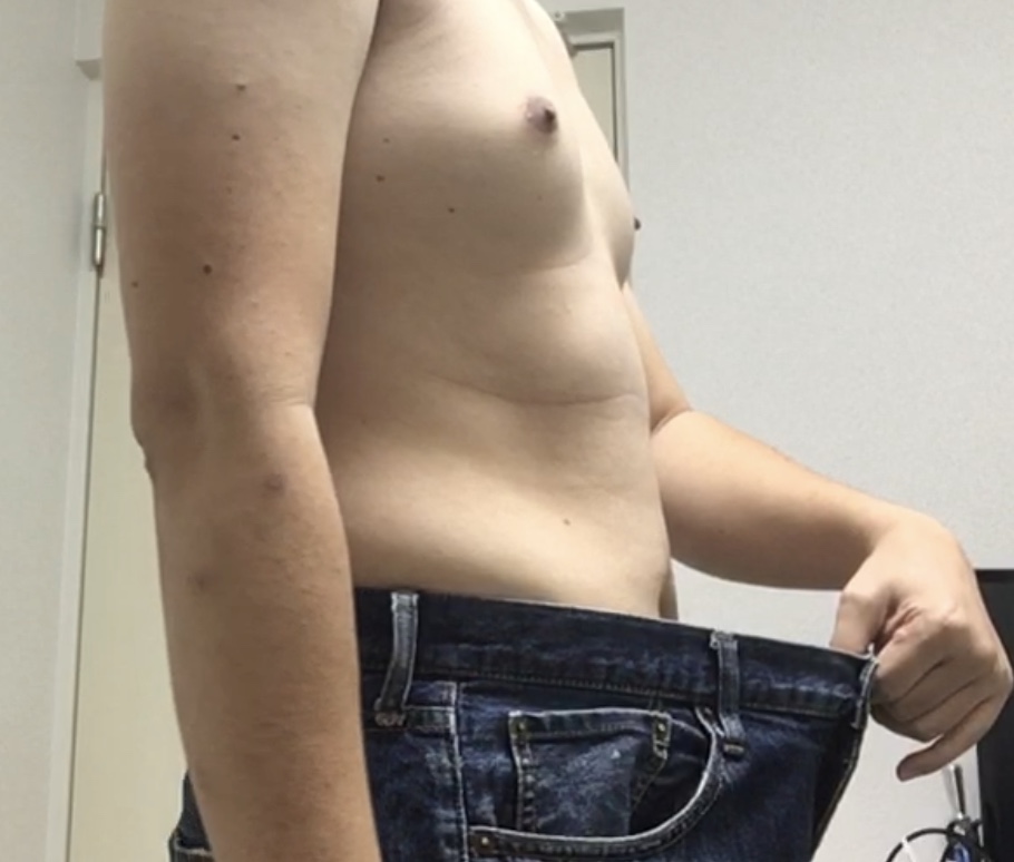 f:id:netvizinfo:20171230070708j:plain