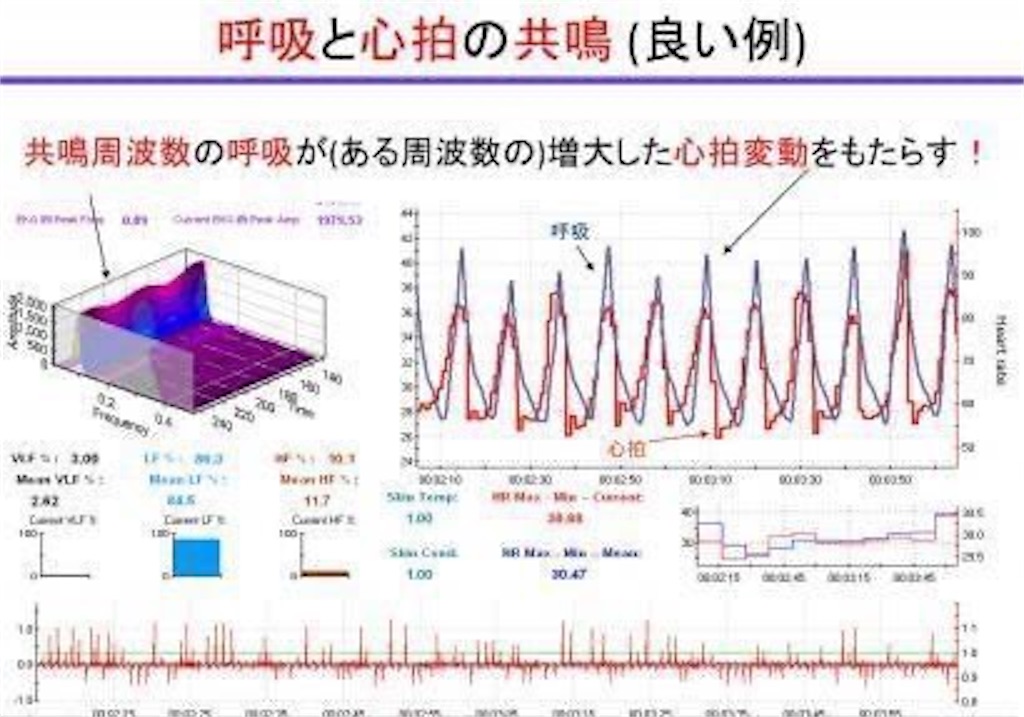 f:id:neurolab123:20230207143644j:image f:id:neurolab123:20230207143644j:image
