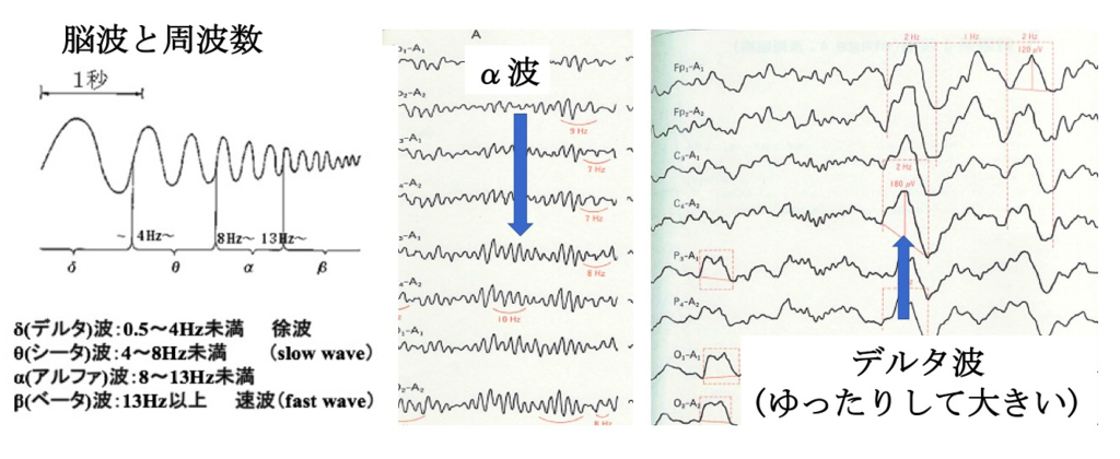 f:id:neurophys11:20170304132356p:plain:w400:right