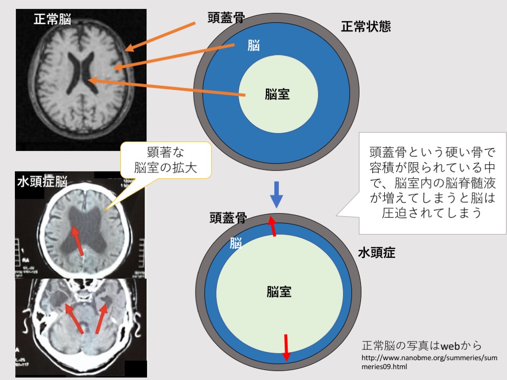 医学上の 痴呆 は Dementia の訳語であるが 明治５年の 医語類聚 では 狂ノ一種 と訳 辛抱しんちゃんの二代目アメーバブログ