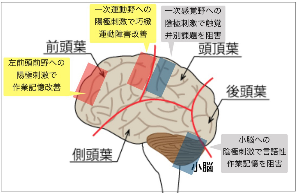 f:id:neurophys11:20180110144838j:plain:w300:right