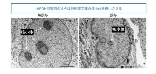 f:id:newspaper-ama:20190816194944p:plain