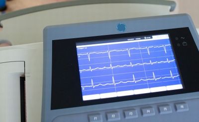 心電図で正常を確認 心電図で正常を確認