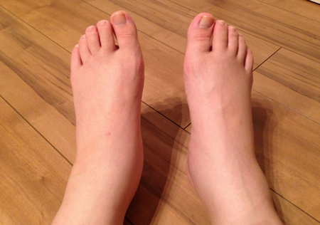 産後の足のむくみ 産後の足のむくみ