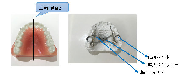 f:id:nihonbashi-gem:20170428175955p:plain f:id:nihonbashi-gem:20170428175955p:plain