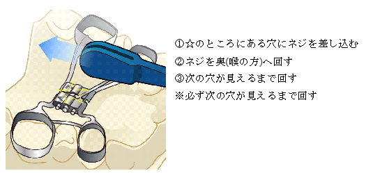 f:id:nihonbashi-gem:20170428180731p:plain f:id:nihonbashi-gem:20170428180731p:plain
