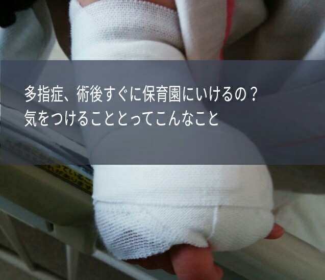 f:id:nimamen:20170412081709j:image
