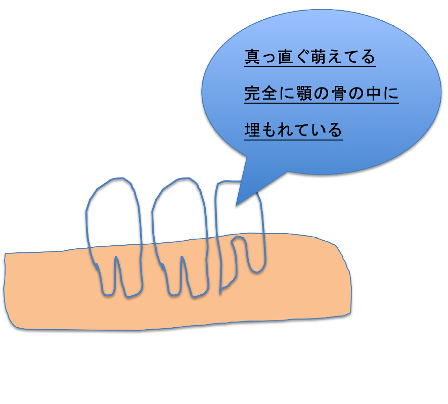 f:id:ninjalifegudaguda:20190109134429p:plain f:id:ninjalifegudaguda:20190109134429p:plain