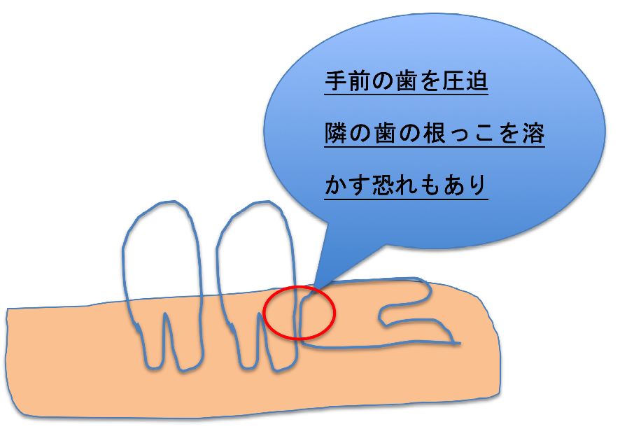 f:id:ninjalifegudaguda:20190109135431p:plain f:id:ninjalifegudaguda:20190109135431p:plain