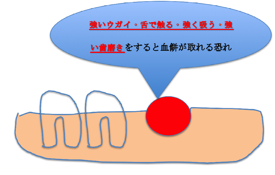 f:id:ninjalifegudaguda:20190121202150p:plain f:id:ninjalifegudaguda:20190121202150p:plain