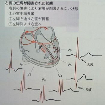 f:id:nishionishi:20101031191645j:image