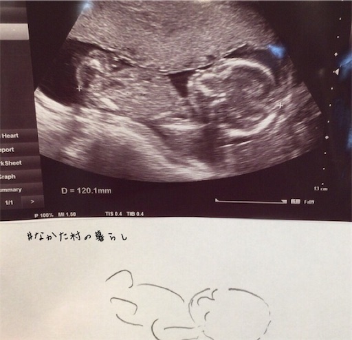 f:id:nktfamily:20190318004839j:image