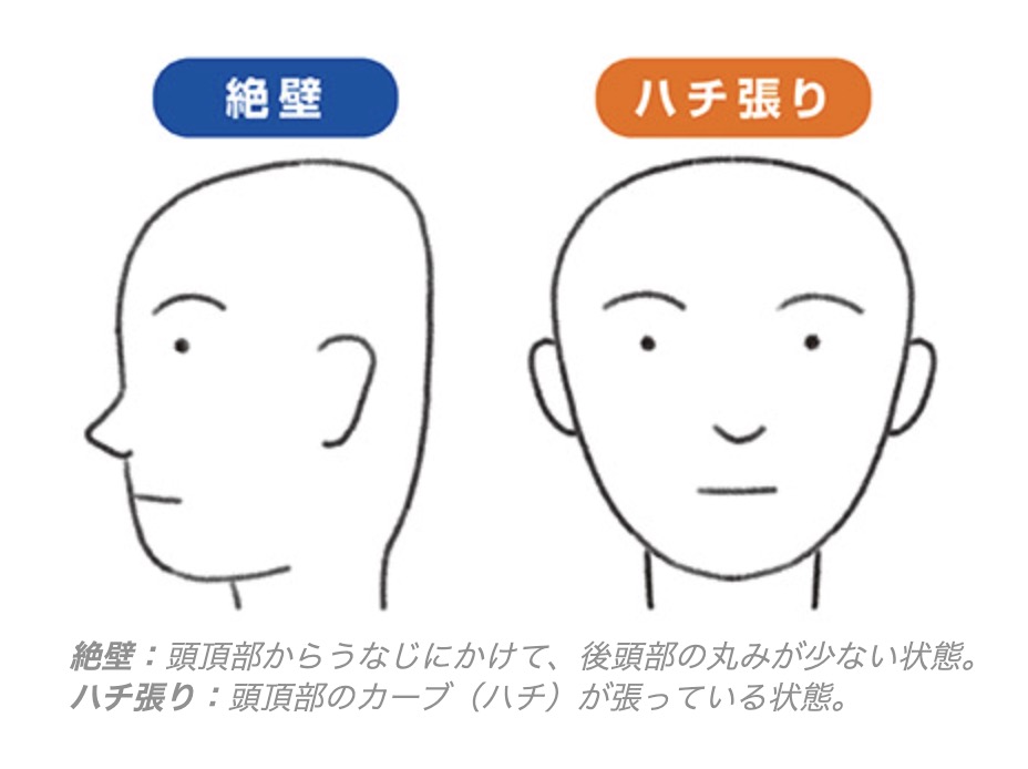 絶壁ハチ張り頭の私が愛用するランニングキャップ ベスト3 - 猫5匹と暮らすおじさんランナーの日記