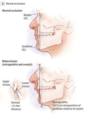 f:id:noboru-_-0913:20210412202843p:plain