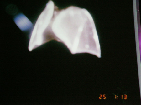 f:id:noken:20081118200054j:image f:id:noken:20081118200054j:image