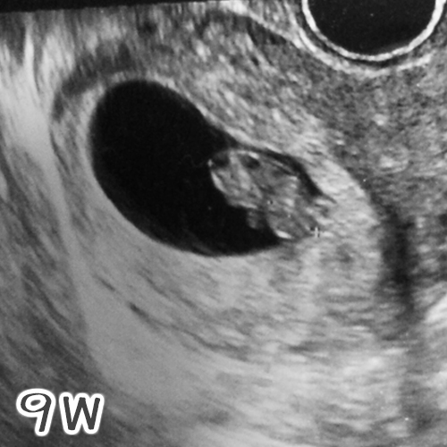 f:id:nonbirikei:20160925164130j:plain f:id:nonbirikei:20160925164130j:plain