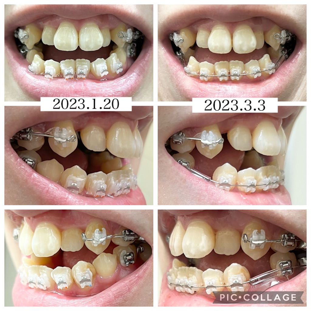 f:id:nonoino:20230321153048j:image