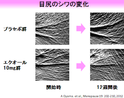 f:id:noon8:20160416112432p:plain