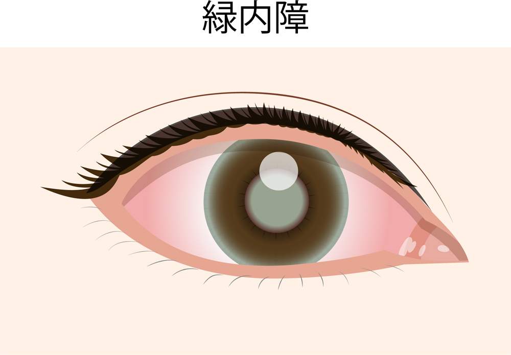 f:id:noriopiano:20201024155602j:plain f:id:noriopiano:20201024155602j:plain