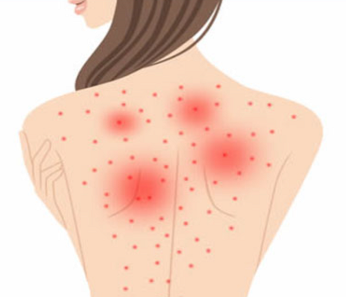 f:id:norisuke80:20170831123625j:plain f:id:norisuke80:20170831123625j:plain