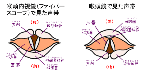仮声帯の図, 仮声帯発声とは – HBXWVF