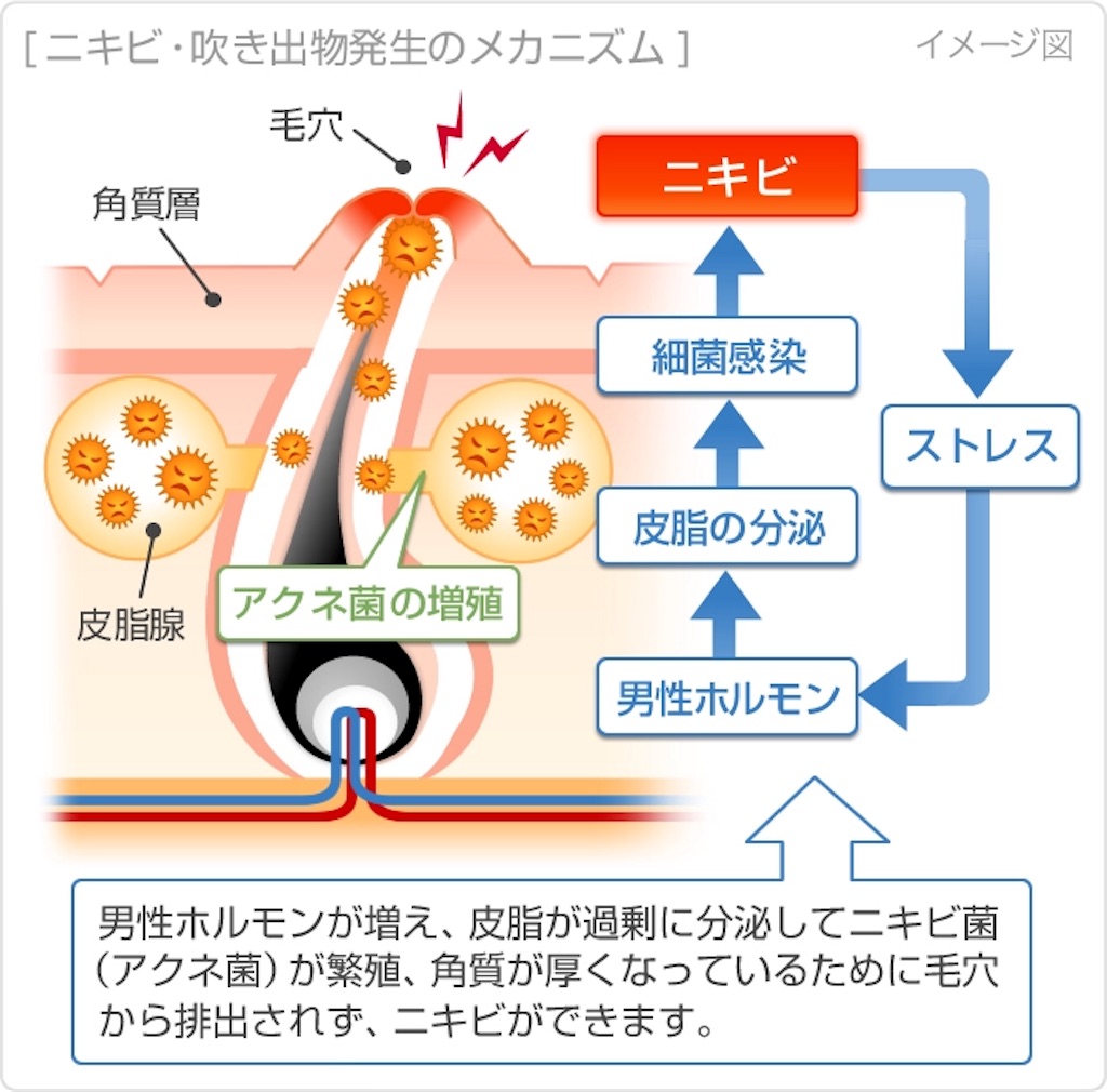 男性 大人 にきび 原因 男性 大人 にきび 原因