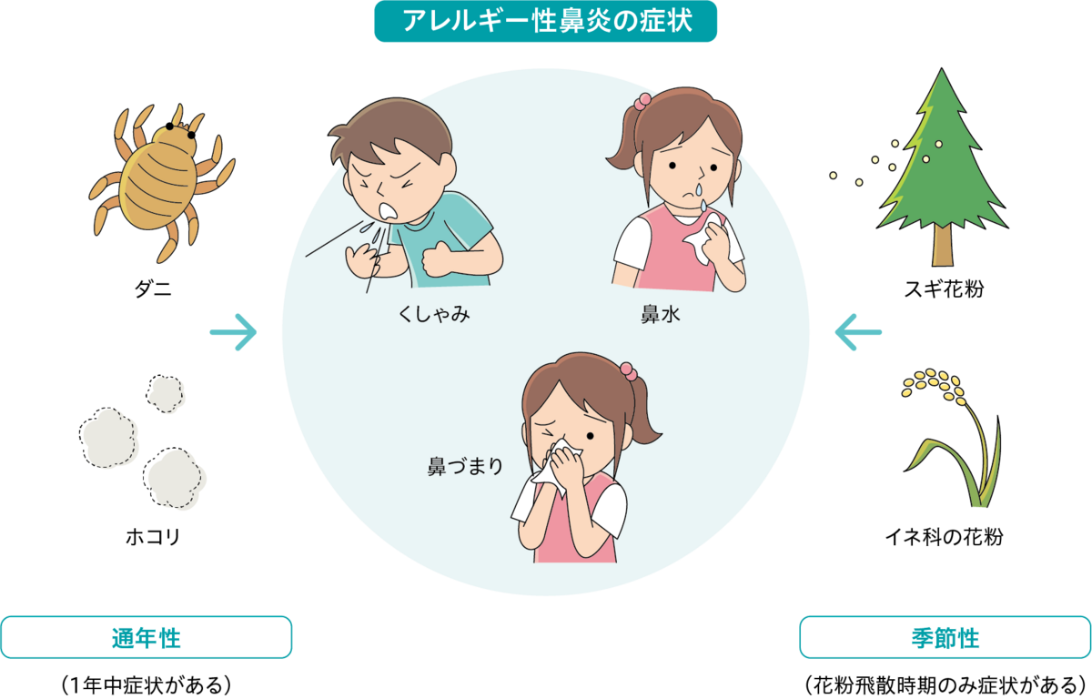 アレルギー性鼻炎の発作を制御するにはどうすればよいですか?