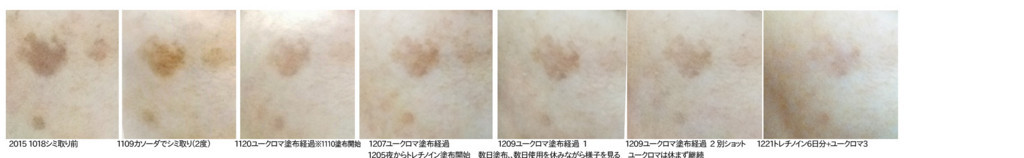 f:id:nvs:20170703145908j:plain f:id:nvs:20170703145908j:plain