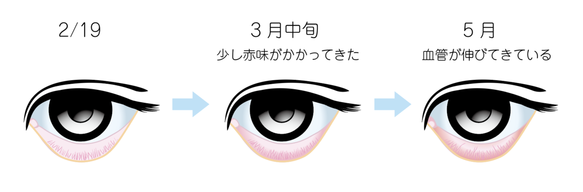 f:id:nvs:20210511151612p:plain