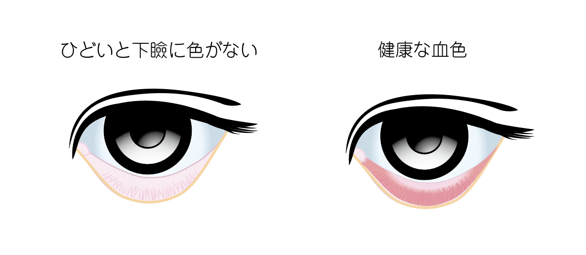 f:id:nvs:20210511151638p:plain