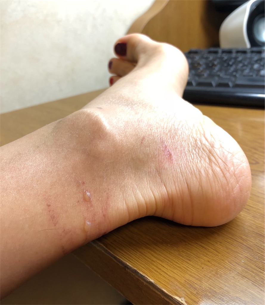 f:id:nyakadai:20180920224505j:image