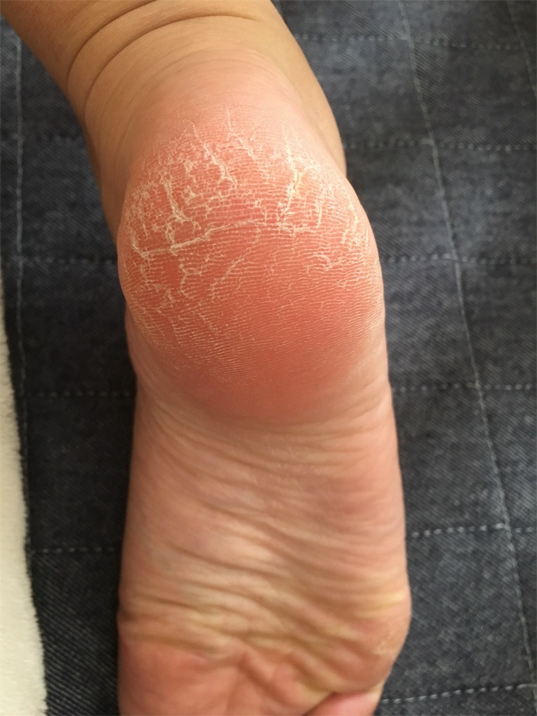 f:id:nyanndanana:20170119114056j:plain