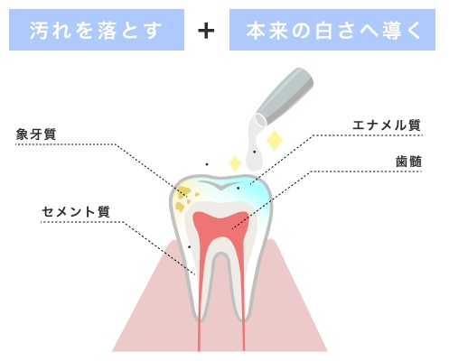 Fメタリックポリリン酸の力