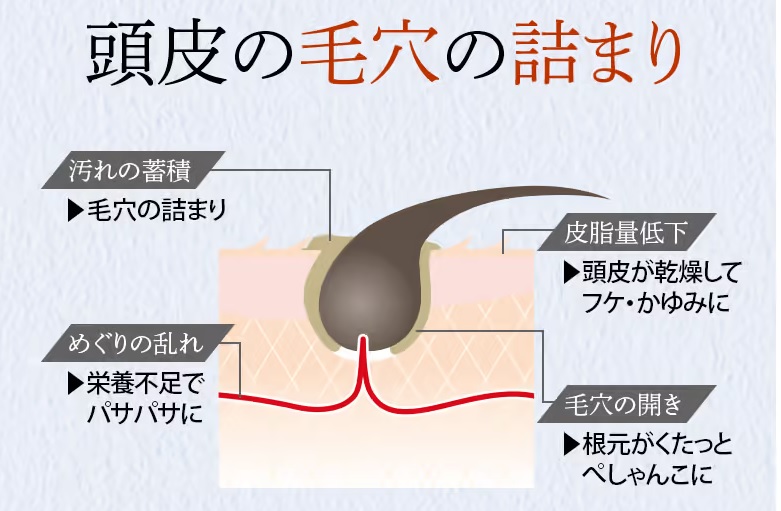 毛穴のつまりによる影響