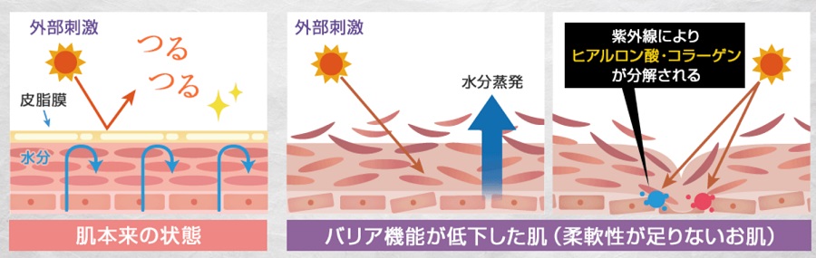 バリア機能の低下