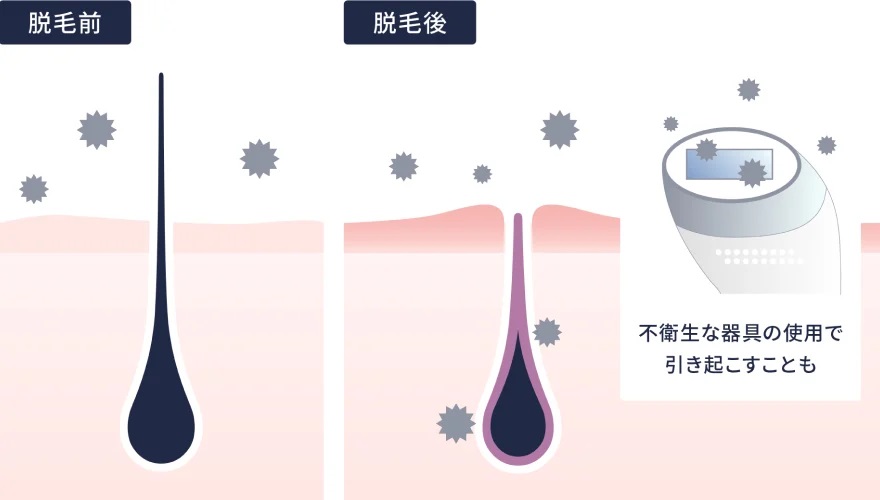 オートクリーンシステムで毎日清潔に