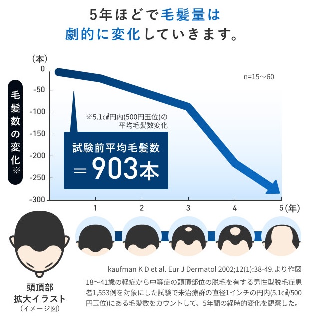 毛髪量は変化しやすい