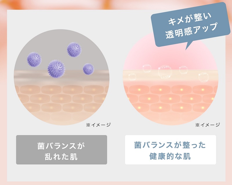 菌バランス