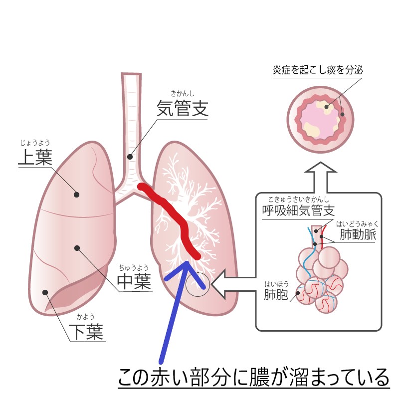 f:id:obasit-n1731:20201022194819j:plain
