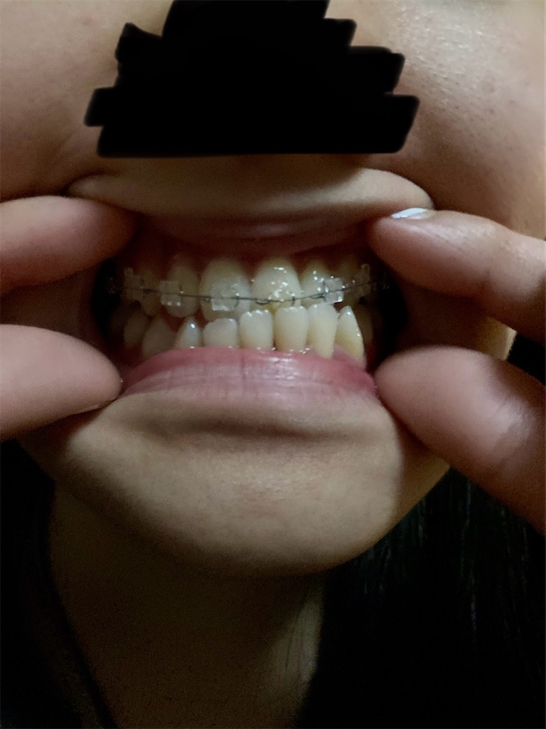f:id:obsessedwithher:20241201181717j:image