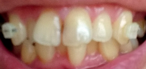 f:id:ofuna24:20210714231147j:plain