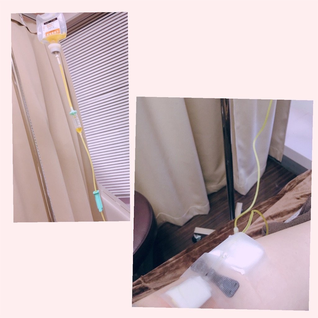 f:id:ohadalog:20181228152857j:image f:id:ohadalog:20181228152857j:image